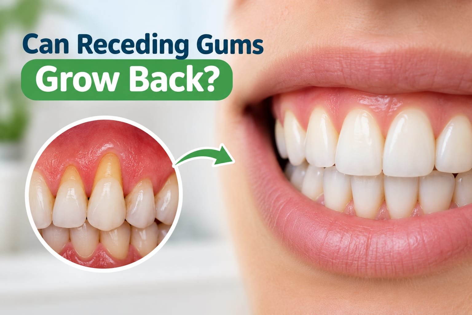 Can Receding Gums Grow Back? Causes and Treatment